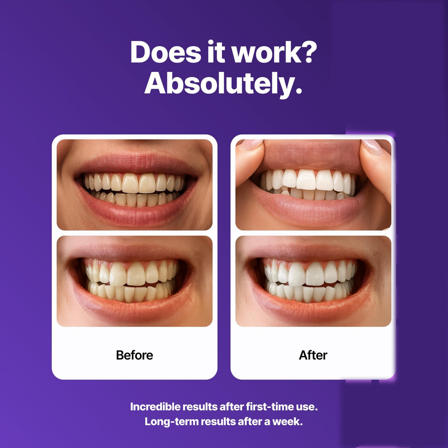 Purple Whitening Strips – 7/21 Sessions | Peroxide-Free, Non-Sensitive