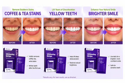 Purple Whitening Strips – 7/21 Sessions | Peroxide-Free, Non-Sensitive